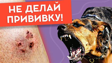 Как действовать, если вас укусила беспризорная собака: понятная инструкция
