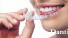 Ako rýchlo vyrovnať zuby bez strojčeka doma?
