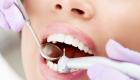 Dolore al dente dopo il riempimento del canale radicolare