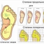 Ginnastica efficace per il trattamento del piede piatto trasversale