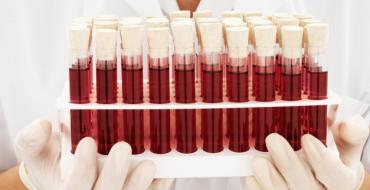 रक्त प्रकार: विशेषताएँ और अनुकूलता