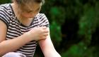 Ako používať fenistil proti bodnutiu komárom pre deti