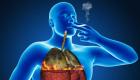 Batuk perokok atau bronkitis, cara menghilangkannya dan gejalanya